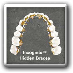 Incognito braces